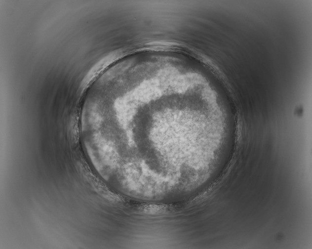 X0000115211362200912091148