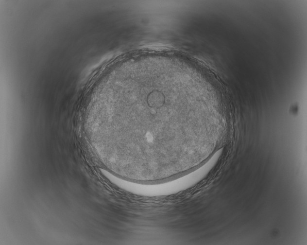 X0000115211398200912091147