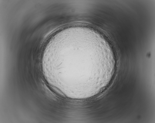 X0000115211402200912091147