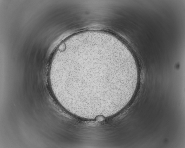 X0000115211410200912091147