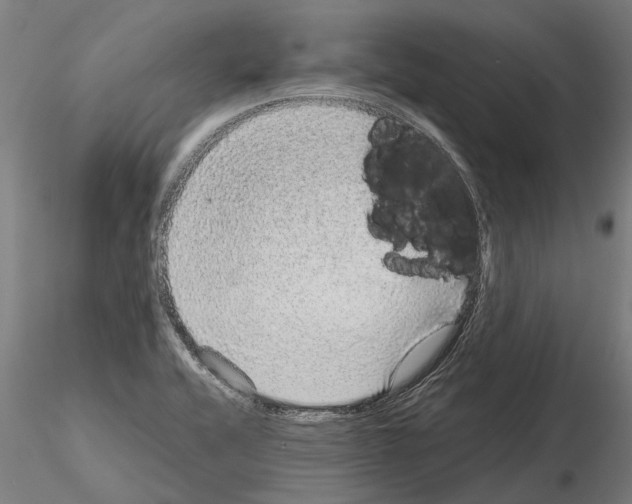 X0000115211416200912091147