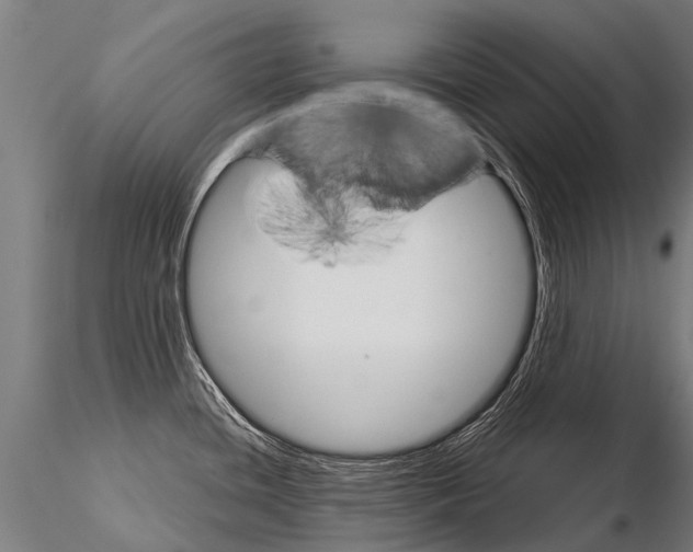 X0000115211436200912091148