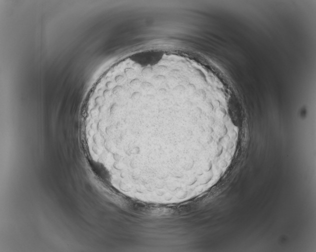 X0000115211467200912091146