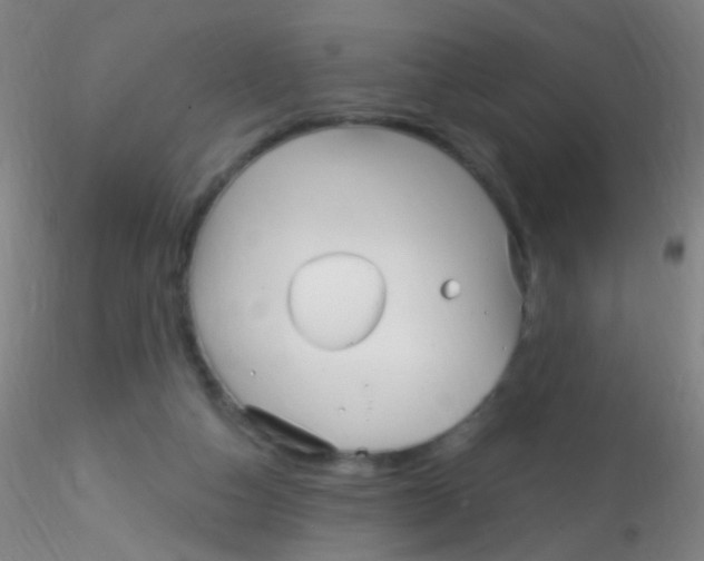 X0000115220162200911251539