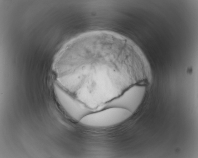 X0000115220165200911251539