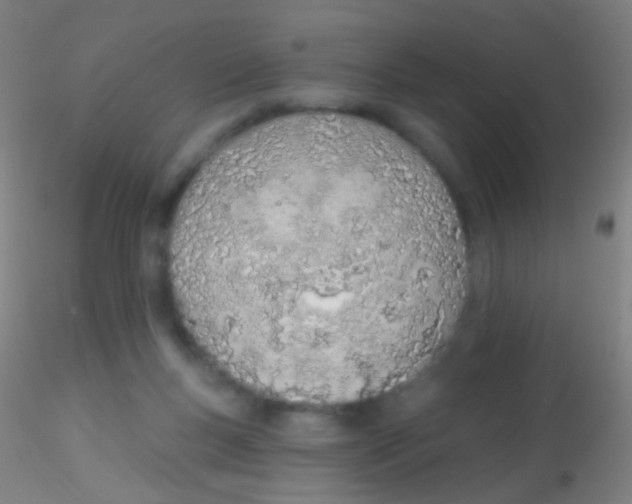 X0000115220167200911251539