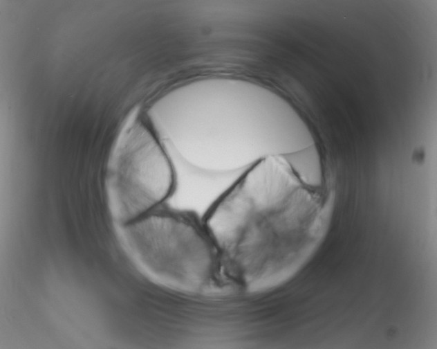 X0000115220169200911251539