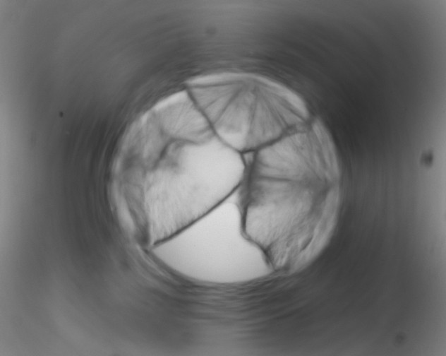 X0000115220185200911251539