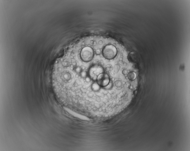 X0000115221106200911251525