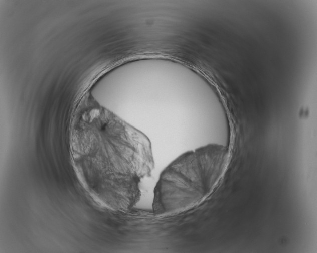 X0000115220145200912091229