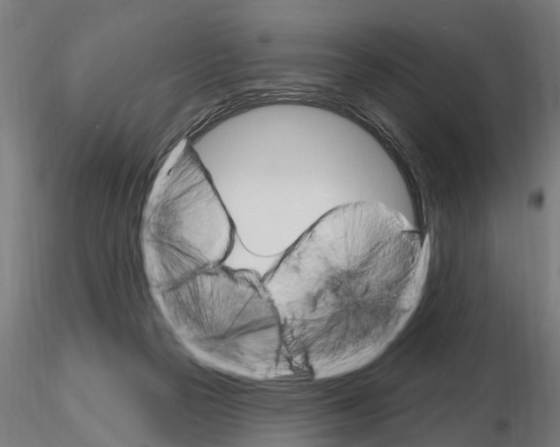 X0000115220169200912091229