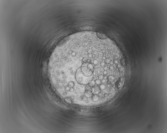 X0000115220171200912091229