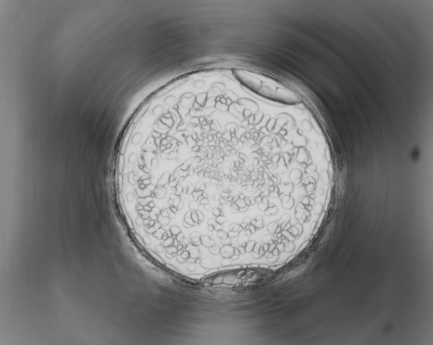 X0000115221149200912091215