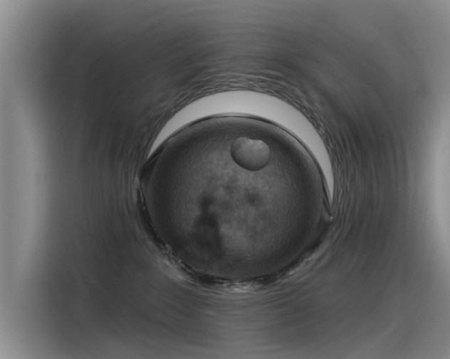 X0000115230235200911061133