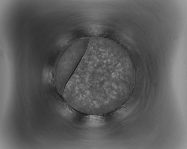 X0000115230528200911061130