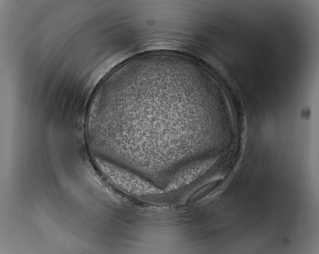 X0000115231121200911201551