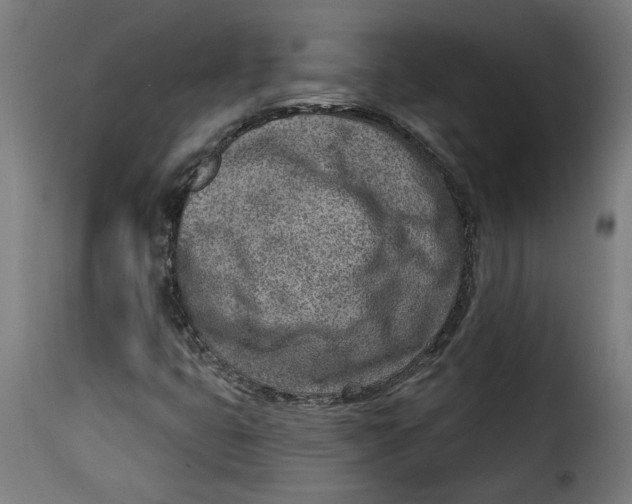 X0000115231399200911201547