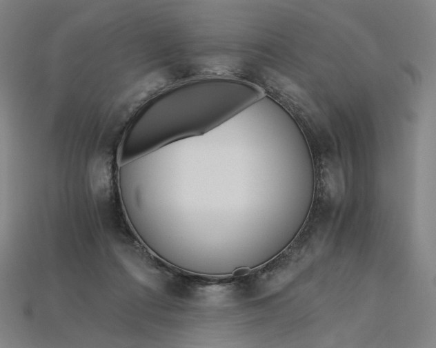 X0000115240312200911131710