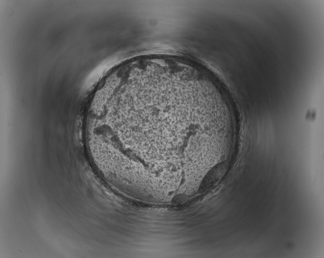 X0000115241455200911201610