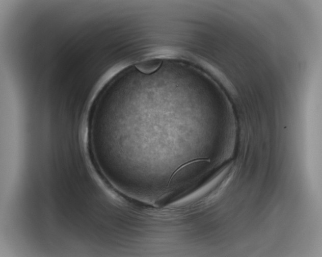 X0000115251418200911061209