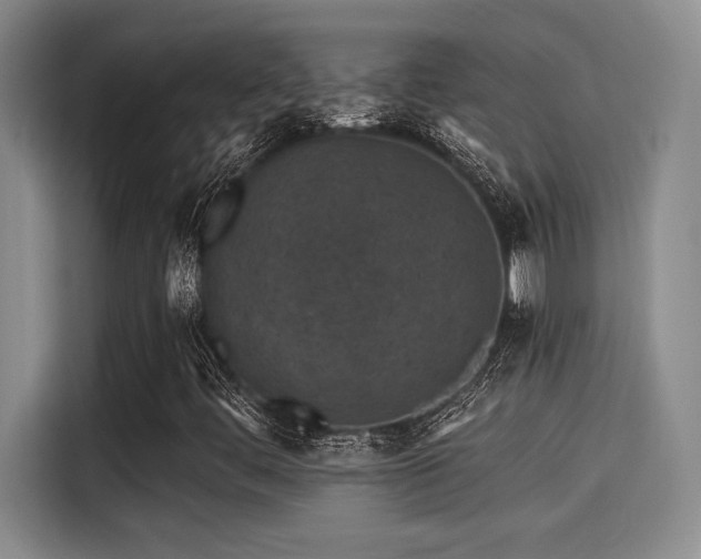 X0000115251444200911061209