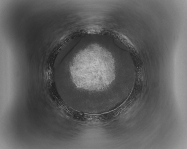 X0000115251445200911061209