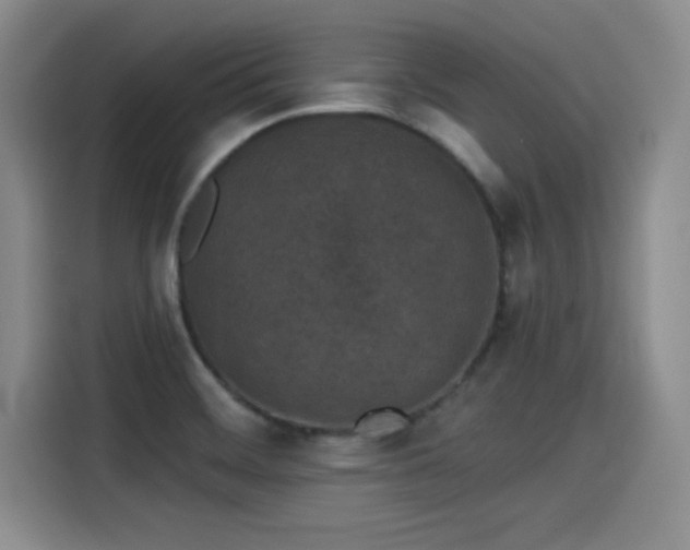 X0000115251468200911061209