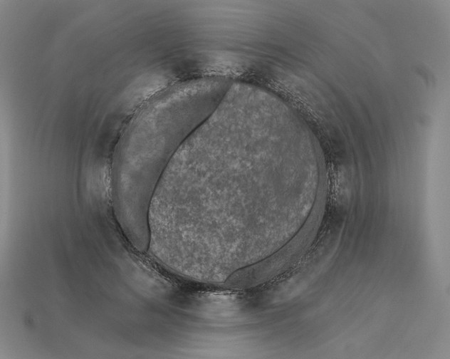 X0000115250692200911131725