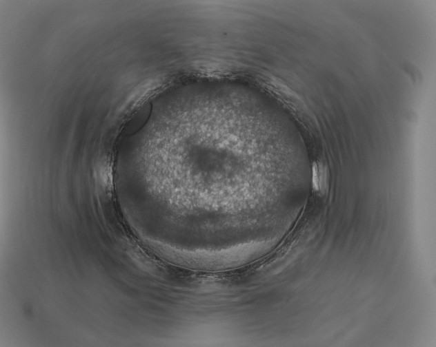 X0000115251155200911131718
