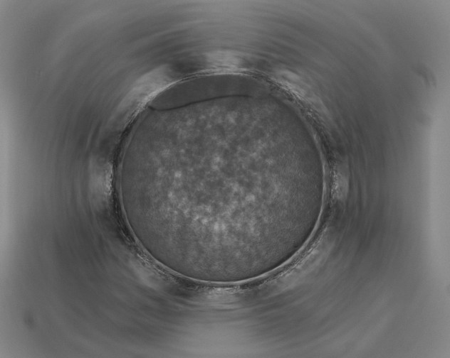 X0000115251161200911131718
