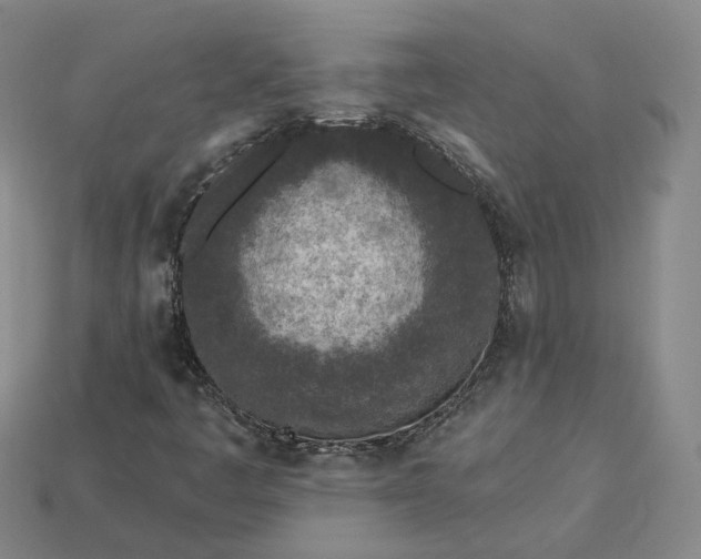 X0000115251445200911131715