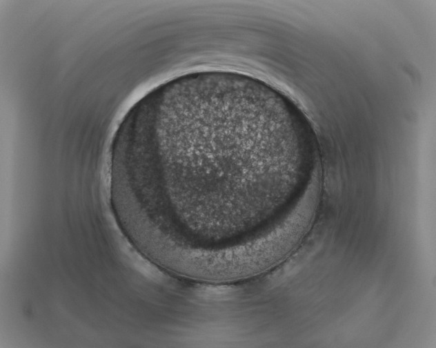 X0000115251522200911131714