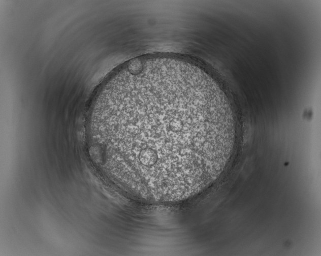 X0000115251266200911201635