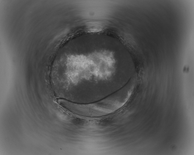 X0000115251441200911201632