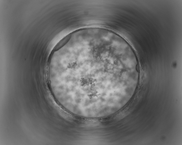 X0000115251101200912111111