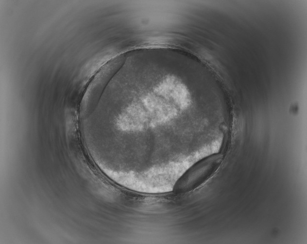 X0000115251449200912111106