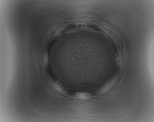 X0000115260231200911061245