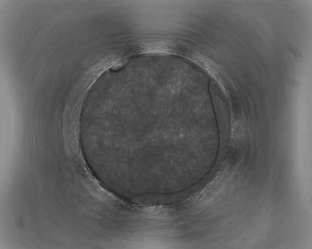 X0000115260385200911131751