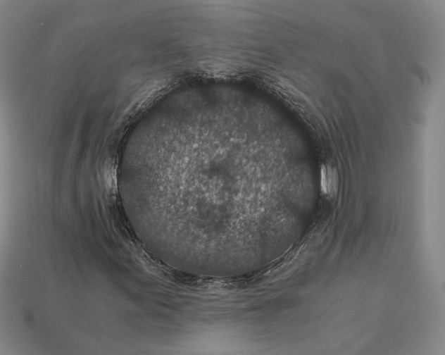X0000115261155200911131740