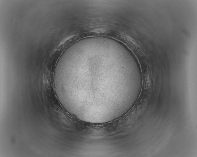 X0000115261158200911131740