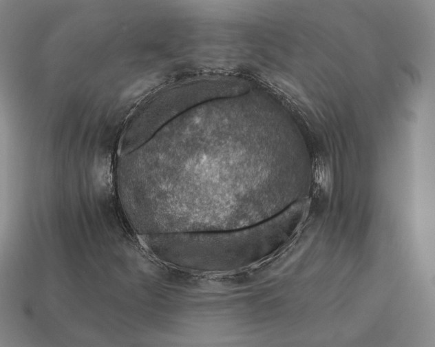 X0000115261252200911131739