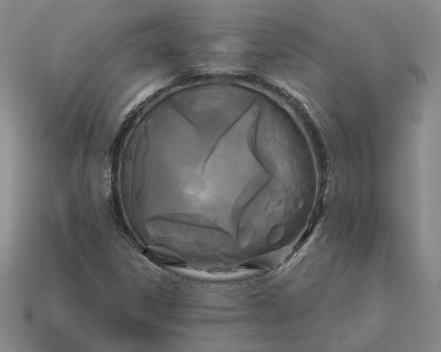 X0000115261306200911131738