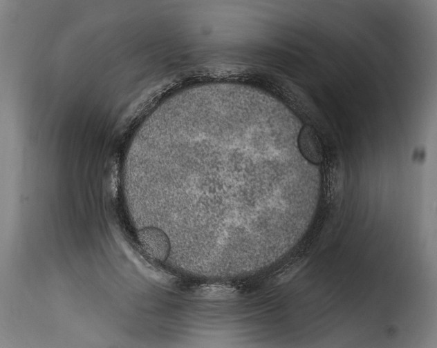 X0000115260644200911201706