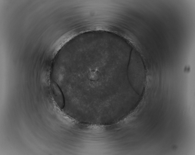 X0000115260977200911201701