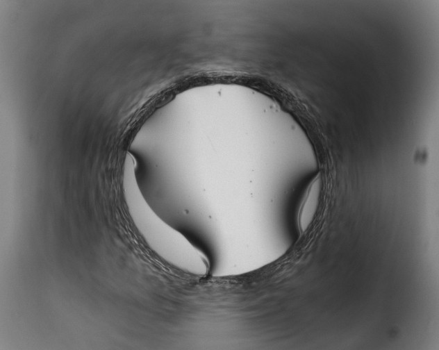 X0000115261157200911201659