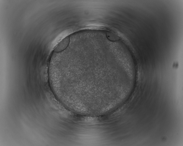X0000115261362200911201655