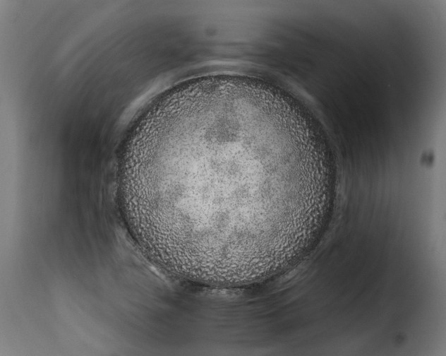 X0000115261411200911201655