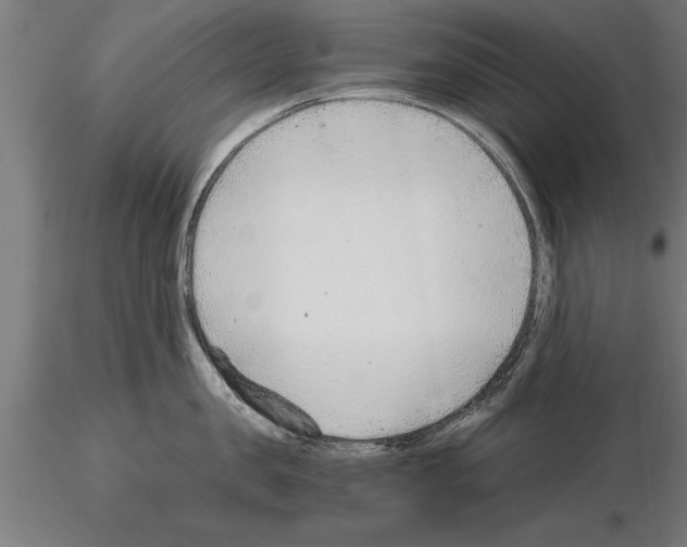 X0000115260957200912111137