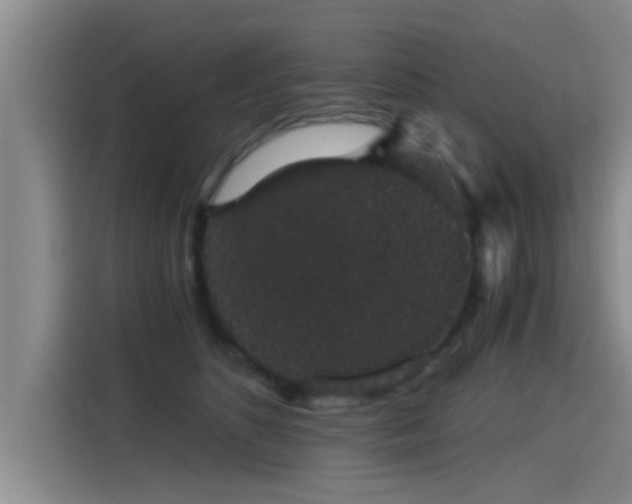 X0000115270516200911061310