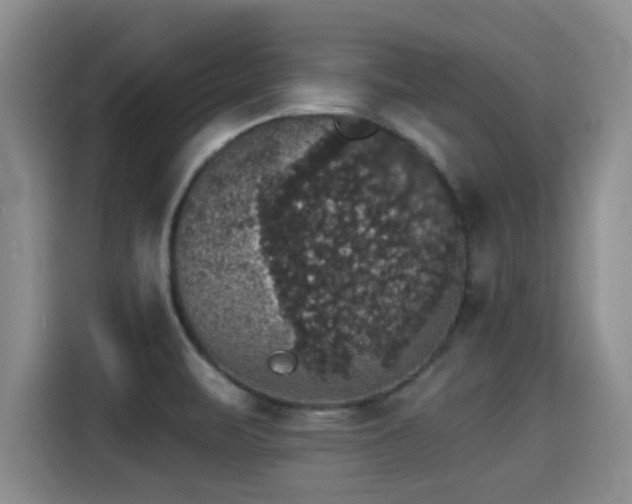 X0000115271471200911061258